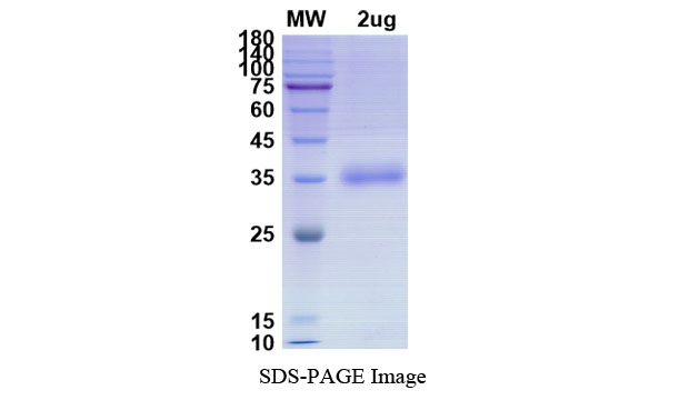 Recombinant 2019-nCoV S Protein RBD (S477N, Mammalian, C-His)